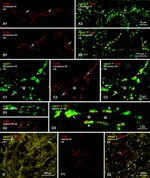 Connexin 36 Antibody in Immunohistochemistry (IHC)
