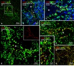 Connexin 36 Antibody in Immunohistochemistry (IHC)