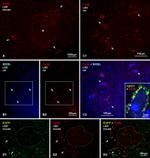 Connexin 36 Antibody in Immunohistochemistry (IHC)