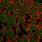Pancreatic duodenal homeobox-1 protein (PDX1) Monoclonal Antibody (PCRP-PDX1-2C11)