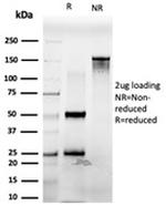 Pancreatic duodenal homeobox-1 protein (PDX1) Antibody in SDS-PAGE (SDS-PAGE)