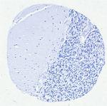 MUM1/IRF4 (Transcription Factor) Recombinant Rabbit Monoclonal Antibody (MUM1/8560R)