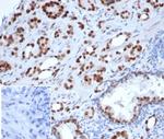 Androgen Receptor Antibody in Immunohistochemistry (Paraffin) (IHC (P))