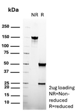 Androgen Receptor (Marker of Androgen Dependence) Antibody in SDS-PAGE (SDS-PAGE)