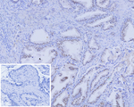 Androgen Receptor (Marker of Androgen Dependence) Recombinant Mouse Monoclonal Antibody (r2F12)