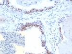 Androgen Receptor V7 (Marker of Androgen Dependence) Antibody in Immunohistochemistry (Paraffin) (IHC (P))