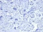 Androgen Receptor Antibody in Immunohistochemistry (Paraffin) (IHC (P))