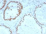 Androgen Receptor (Marker of Androgen Dependence) Recombinant Rabbit Monoclonal Antibody (DHTR/4929R)