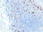 CD103/Integrin E7 Antibody in Immunohistochemistry (Paraffin) (IHC (P))