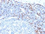 CD103/Integrin alpha-E-beta7 Antibody in Immunohistochemistry (Paraffin) (IHC (P))