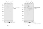 Phospho-GluR1 (Ser845) Antibody in Western Blot (WB)