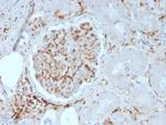 CD29 Antibody in Immunohistochemistry (Paraffin) (IHC (P))