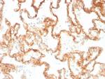 CD29 Antibody in Immunohistochemistry (Paraffin) (IHC (P))