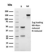CD29 Antibody in SDS-PAGE (SDS-PAGE)
