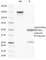 CD104 (Integrin Beta-4) (Squamous Cell Carcinoma Antigen) Monoclonal Antibody (UM-A9)