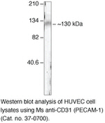 CD31 Monoclonal Antibody (MEM-05)