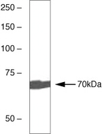 Zap-70 Monoclonal Antibody (1E7.2)