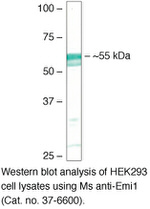 FBXO5 Monoclonal Antibody (3D2D6)