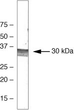 SOCS3 Monoclonal Antibody (1B2)
