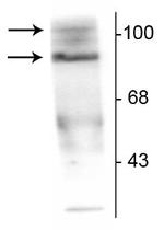 Phospho-Progesterone Receptor (Ser190) Antibody in Western Blot (WB)