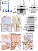 TSC1 Antibody in Immunohistochemistry (IHC)