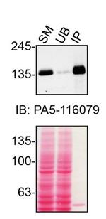 TSC1 Monoclonal Antibody (5C8A12)