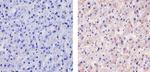 TSC2 Monoclonal Antibody (3G9D9)
