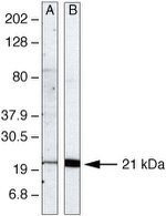 UBC13 Monoclonal Antibody (4E 11)