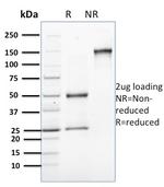 Involucrin (Squamous Cell Terminal Differentiation Marker) Antibody in SDS-PAGE (SDS-PAGE)