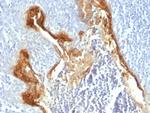 Involucrin (Squamous Cell Terminal Differentiation Marker) Monoclonal Antibody (IVRN/827)
