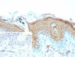 Involucrin (Squamous Cell Terminal Differentiation Marker) Recombinant Mouse Monoclonal Antibody (rIVRN/9323)