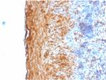 Involucrin Antibody in Immunohistochemistry (Paraffin) (IHC (P))