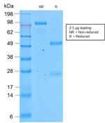 Involucrin Antibody in SDS-PAGE (SDS-PAGE)