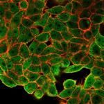 JunB/Transcription Factor JunB Monoclonal Antibody (PCRP-JUNB-3G11)