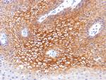 Catenin, gamma Monoclonal Antibody (CTNG, 1483)
