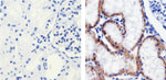 Claudin 1 Antibody in Immunohistochemistry (Paraffin) (IHC (P))