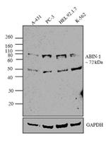 TNIP1 Monoclonal Antibody (1A11E3)