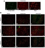 Ubiquilin 1 Antibody in Immunohistochemistry (IHC)