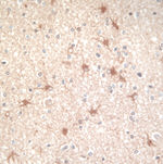 DJ-1 Antibody in Immunohistochemistry (IHC)