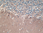 DJ-1 Antibody in Immunohistochemistry (IHC)