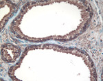 DJ-1 Antibody in Immunohistochemistry (IHC)
