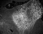 O-acetyl GD3 Antibody in Immunohistochemistry (IHC)