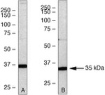 PSMD14 Antibody in Western Blot (WB)