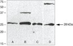 PSME1 Antibody in Western Blot (WB)