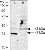 WNT2B Polyclonal Antibody