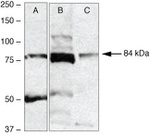 RSK2 Polyclonal Antibody