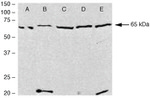 PDLIM5 Antibody in Western Blot (WB)