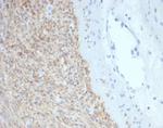 CD117/c-Kit (Marker for Gastrointestinal Stromal Tumors) Monoclonal Antibody (C117/7119)