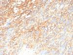 CD117/c-Kit (Marker for Gastrointestinal Stromal Tumors) Recombinant Mouse Monoclonal Antibody (rC117/9253)