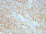 CD117/c-Kit (Marker for Gastrointestinal Stromal Tumors) Recombinant Rabbit Monoclonal Antibody (C117/8399R)